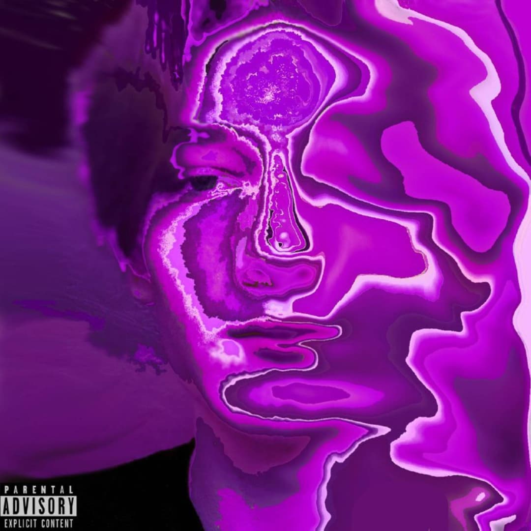 Amnesia